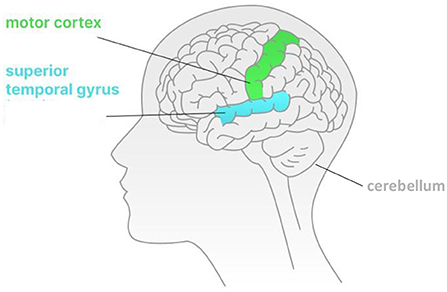 图2 -左脑的侧视图。