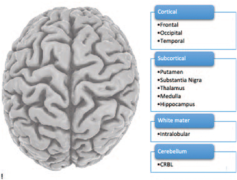 图1——人类大脑包括10个大脑区域。