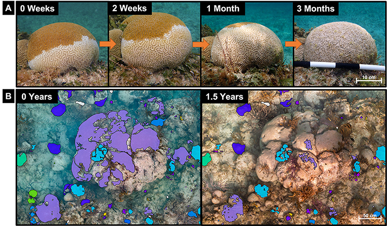 (图1)-一个槽的殖民地脑珊瑚(Diploria labyrinthiformis)感染SCTLD。